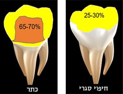 חיפוי חרסינה סגרי לעומת כתר